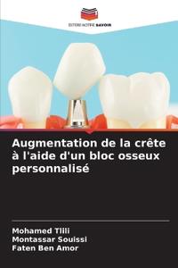 Augmentation de la crête à l'aide d'un bloc osseux personnalisé