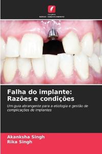 Falha do implante