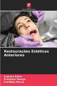 Restaurações Estéticas Anteriores