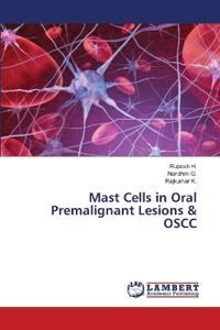 Mast Cells in Oral Premalignant Lesions & OSCC