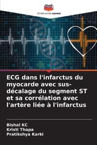 ECG dans l'infarctus du myocarde avec sus-décalage du segment ST et sa corrélation avec l'artère liée à l'infarctus