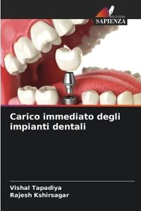 Carico immediato degli impianti dentali