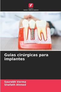 Guias cirúrgicas para implantes