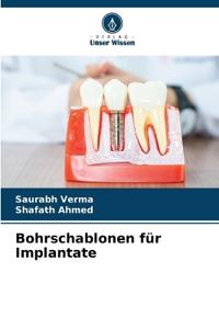 Bohrschablonen für Implantate