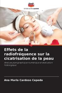 Effets de la radiofréquence sur la cicatrisation de la peau