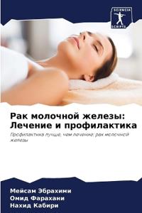 Рак молочной железы