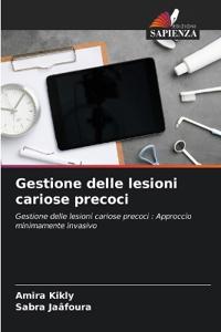 Gestione delle lesioni cariose precoci