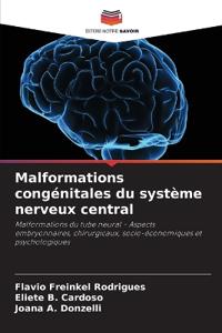 Malformations congénitales du système nerveux central