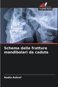 Schema delle fratture mandibolari da caduta