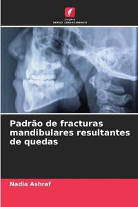 Padrão de fracturas mandibulares resultantes de quedas