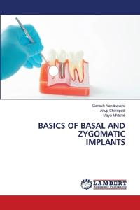 Basics of Basal and Zygomatic Implants