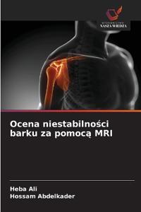 Ocena niestabilnosci barku za pomoca MRI