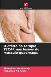 O efeito da terapia TECAR nas lesões do músculo quadríceps