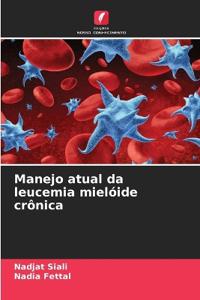 Manejo atual da leucemia mielóide crônica