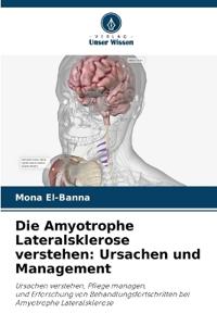 Die Amyotrophe Lateralsklerose verstehen
