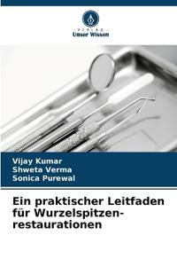 Ein praktischer Leitfaden für Wurzelspitzen- restaurationen