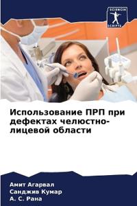 Использование ПРП при дефектах челюстно-л