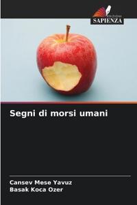 Segni di morsi umani