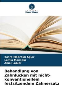 Behandlung von Zahnlücken mit nicht-konventionellem festsitzendem Zahnersatz