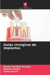 Guias cirúrgicos de implantes