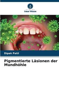 Pigmentierte Läsionen der Mundhöhle