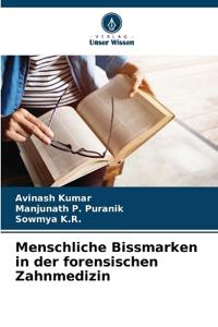 Menschliche Bissmarken in der forensischen Zahnmedizin