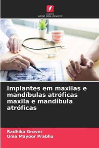 Implantes em maxilas e mandíbulas atróficas maxila e mandíbula atróficas