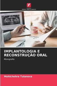 Implantologia E Reconstrução Oral