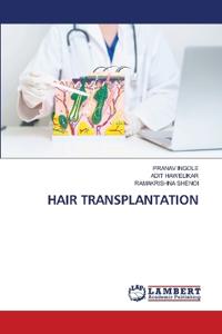 Hair Transplantation