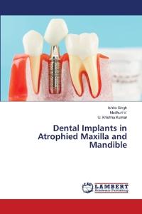 Dental Implants in Atrophied Maxilla and Mandible