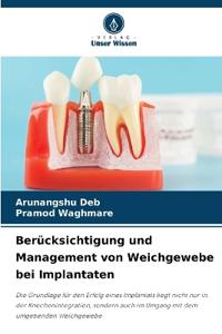 Berücksichtigung und Management von Weichgewebe bei Implantaten