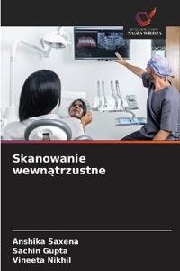 Skanowanie wewnatrzustne