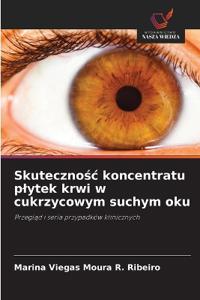 Skutecznosc koncentratu plytek krwi w cukrzycowym suchym oku