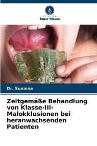Zeitgemäße Behandlung von Klasse-III-Malokklusionen bei heranwachsenden Patienten