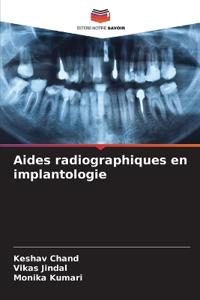 Aides radiographiques en implantologie
