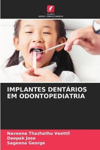 Implantes Dentários Em Odontopediatria