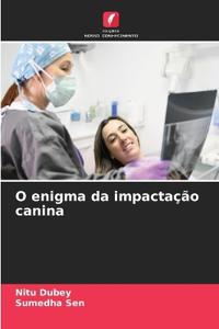 O enigma da impactação canina