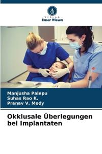 Okklusale Überlegungen bei Implantaten