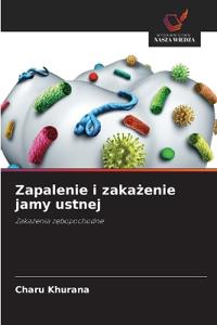 Zapalenie i zakażenie jamy ustnej