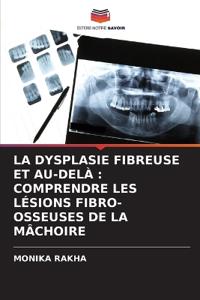 La Dysplasie Fibreuse Et Au-Delà