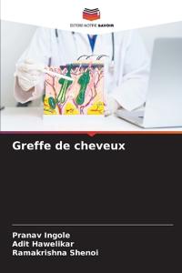 Greffe de cheveux