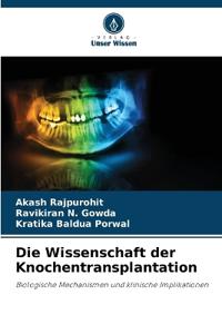 Die Wissenschaft der Knochentransplantation