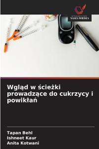 Wgląd w ścieżki prowadzące do cukrzycy i powiklań