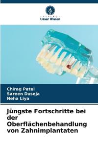 Jüngste Fortschritte bei der Oberflächenbehandlung von Zahnimplantaten