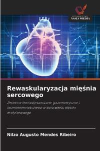 Rewaskularyzacja miesnia sercowego