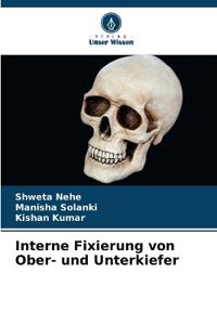 Interne Fixierung von Ober- und Unterkiefer