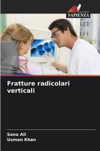 Fratture radicolari verticali