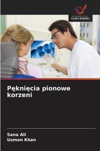 Pęknięcia pionowe korzeni
