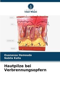 Hautpilze bei Verbrennungsopfern