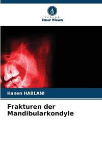Frakturen der Mandibularkondyle